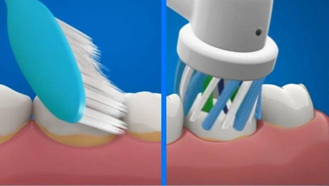 bàn chải điện oral b đánh bật mọi mảng bám trên răng